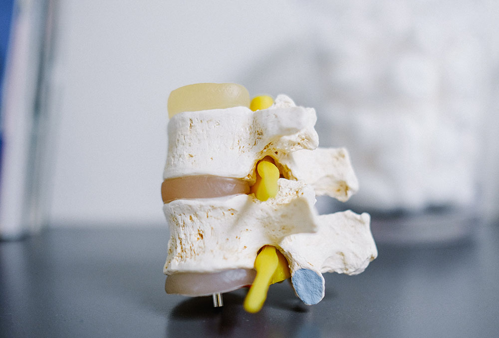 Why You Need to Take Bone Cancer Seriously