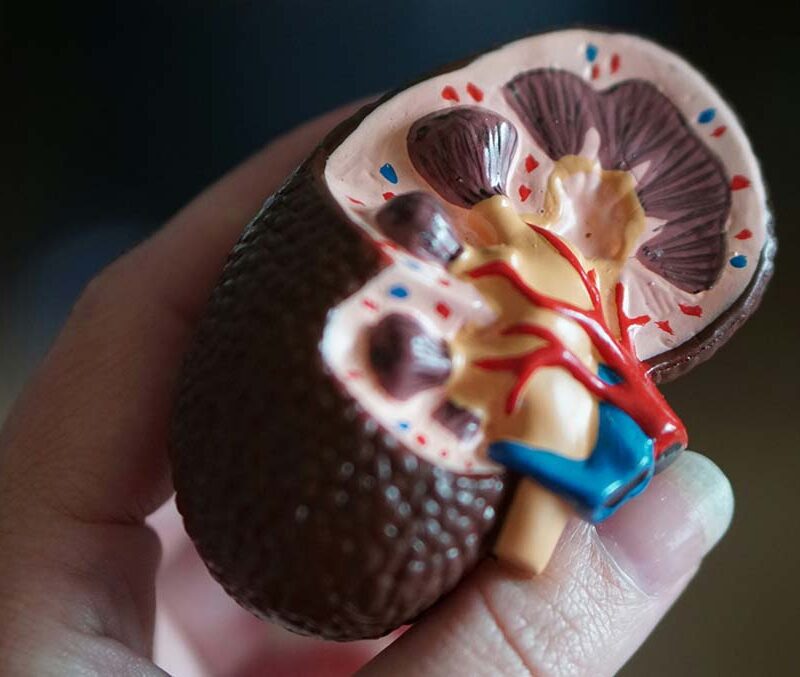 a medical model of a kidney cross sections held in someone's hand.