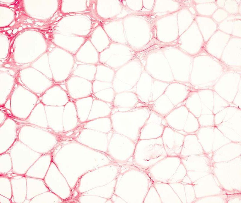 many white cells on a pink background