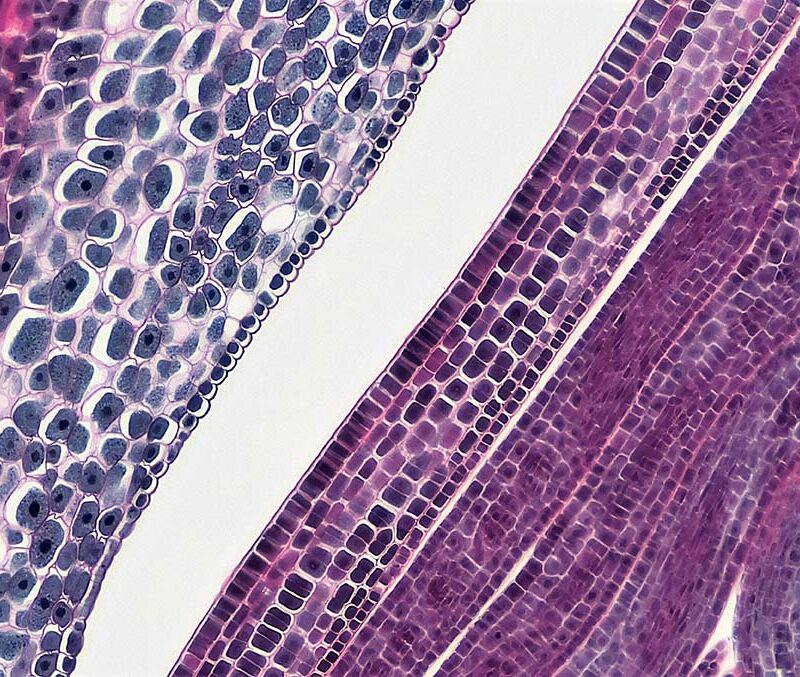 Pancreatic cancer cells