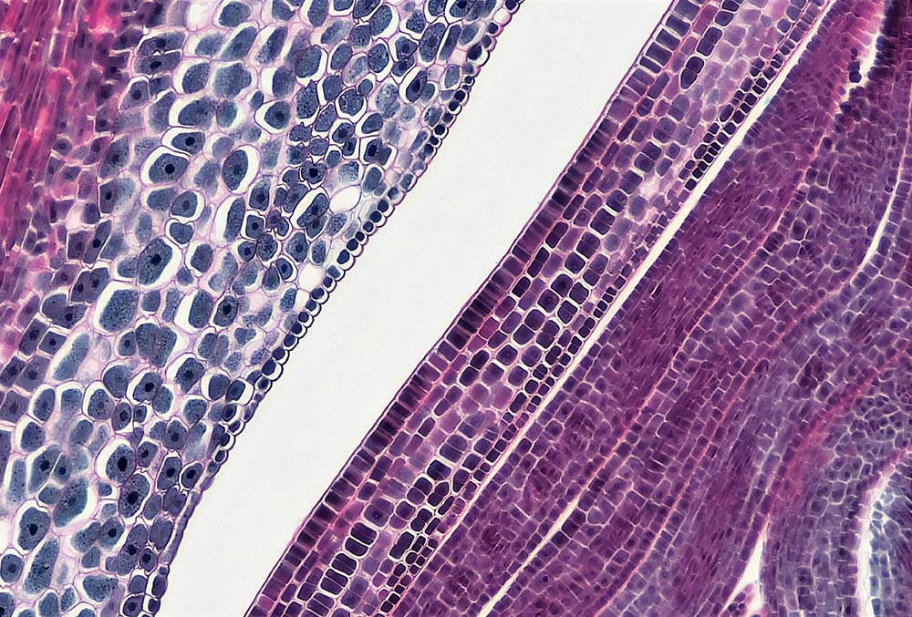 Comprehensive Cancer Centers Notes Progress on Pancreatic Cancer Treatments