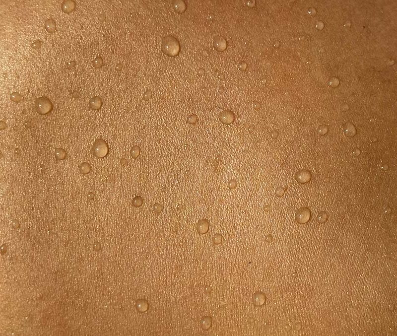 A photo of skin cells.