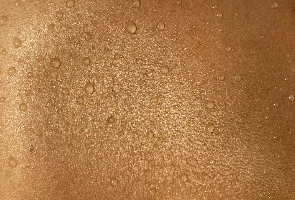 Comprehensive Cancer Centers Details About Melanoma Skin Cancer