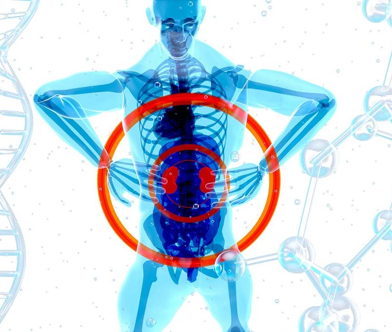 A X-ray of a human body with kidneys visible in red.